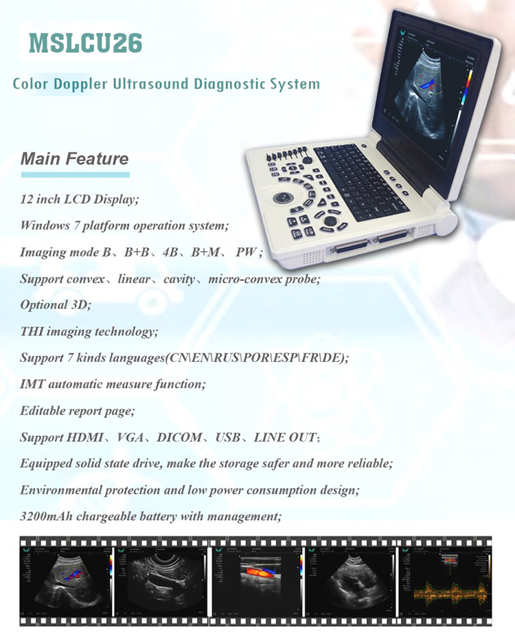 Best Cheap Price Medical Ultrasound Diagnostic System Laptop Portable Color Doppler Ultrasound Machine for Hospital