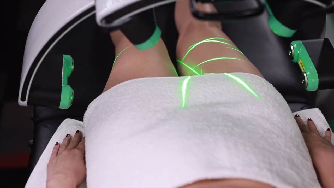 10D Cold Laser Therapy Machine Green Diode Light Emerald Laser Liposuction Lypolysis Master Machine