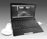 Digital Portable Mobile Laptop Ultrasound Scanner Medical Equipment BIO 3000J