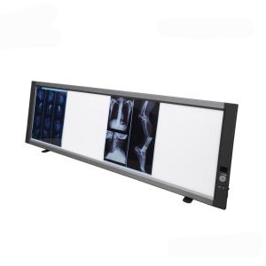 Wholesale X Ray Film Viewer / Quadruble Panel Medical LED Film Viewer from china suppliers