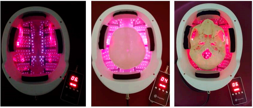 Photobiomodulation Light Therapy Machine Infrared Therapeutic Instrument 810nm