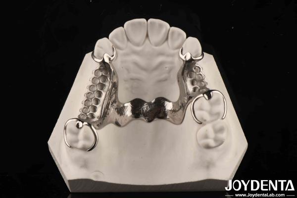 Clinical Practice Dental Alloying Metal Framework Good Fit In The Mouth