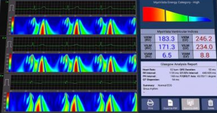 6 channel medical vital monitor easy portable hospital ECG monitor with software