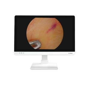 Wholesale 4K FHD Medical Equipment 27 Inch Endoscope Camera Monitor Display For Endoscope from china suppliers