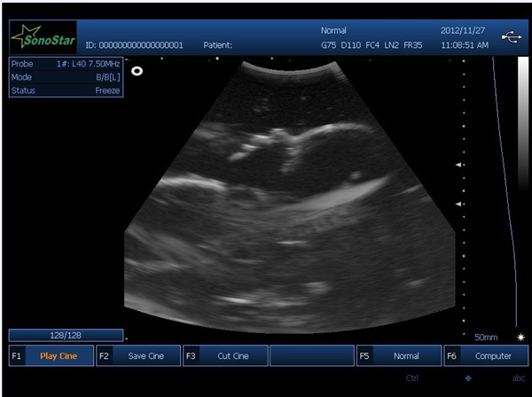 PC based 3D Ultrasound Machine SS-9 Laptop Ultrasound scanner