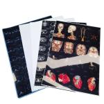 Inkjet Medical Dry Film Transparent Blue X-ray Film For CT DR MRI Radiological