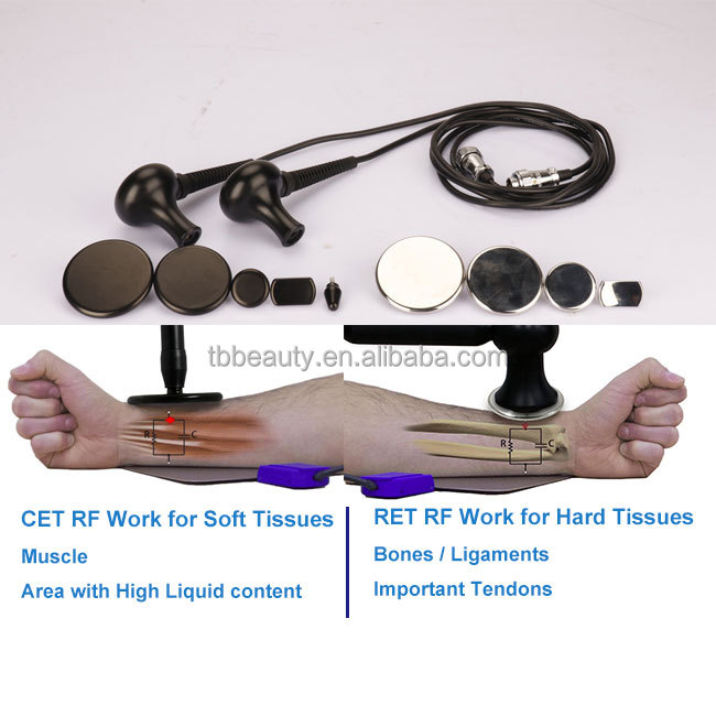 448Khz Tecar Diathermy Smart Physiotherapy Machine Skin Rejuvenation