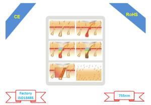 Wholesale Alexandrite Laser Machine Hair Removal Permanent , Painless Alexandrite Lasers from china suppliers