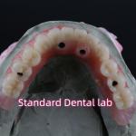 Porcelain Zirconia Dental Implant Bridge Professional High Esthetics With Pink