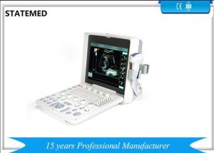 China Color Doppler B Ultrasound Machine Ultrasonography Machine With 2 USB Ports on sale