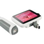 Portable 3.5" Clinica Endoscope 100mm Flexible Laryngoscope