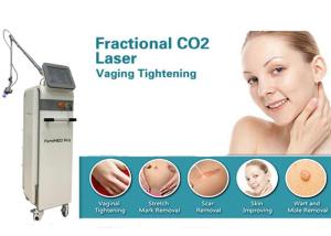 Wholesale Iso Rf Micro Acne Scars Co2 Fractional Laser Machine from china suppliers