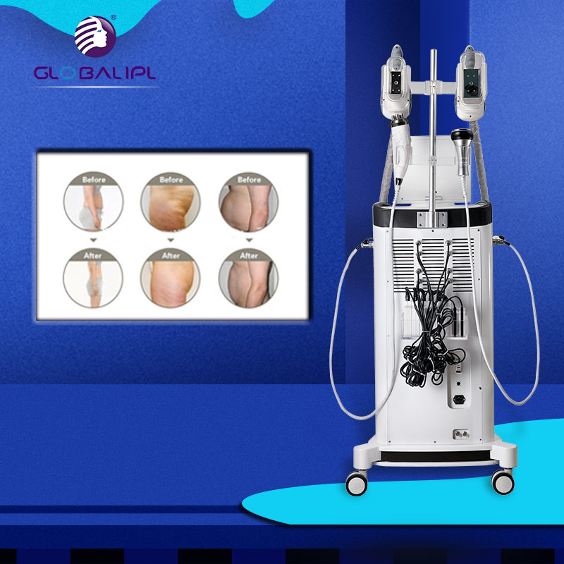 Fat Freezing Cryolipolysis Machine 1000W Output Power Skin Tightening Device