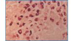 Virus Stain (Orcein staining method)