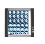 Medical X-ray Dry Film Medical X-ray Inkjet Film With Clear Image Quality