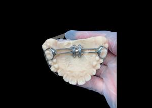 Wholesale MSE Palatal Expander Innovative Orthodontic Appliances For Effective Teeth Alignment from china suppliers