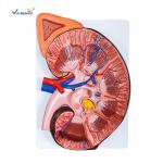 Enlarged Kidney Human Anatomical Model 1 Part Medical Life Size