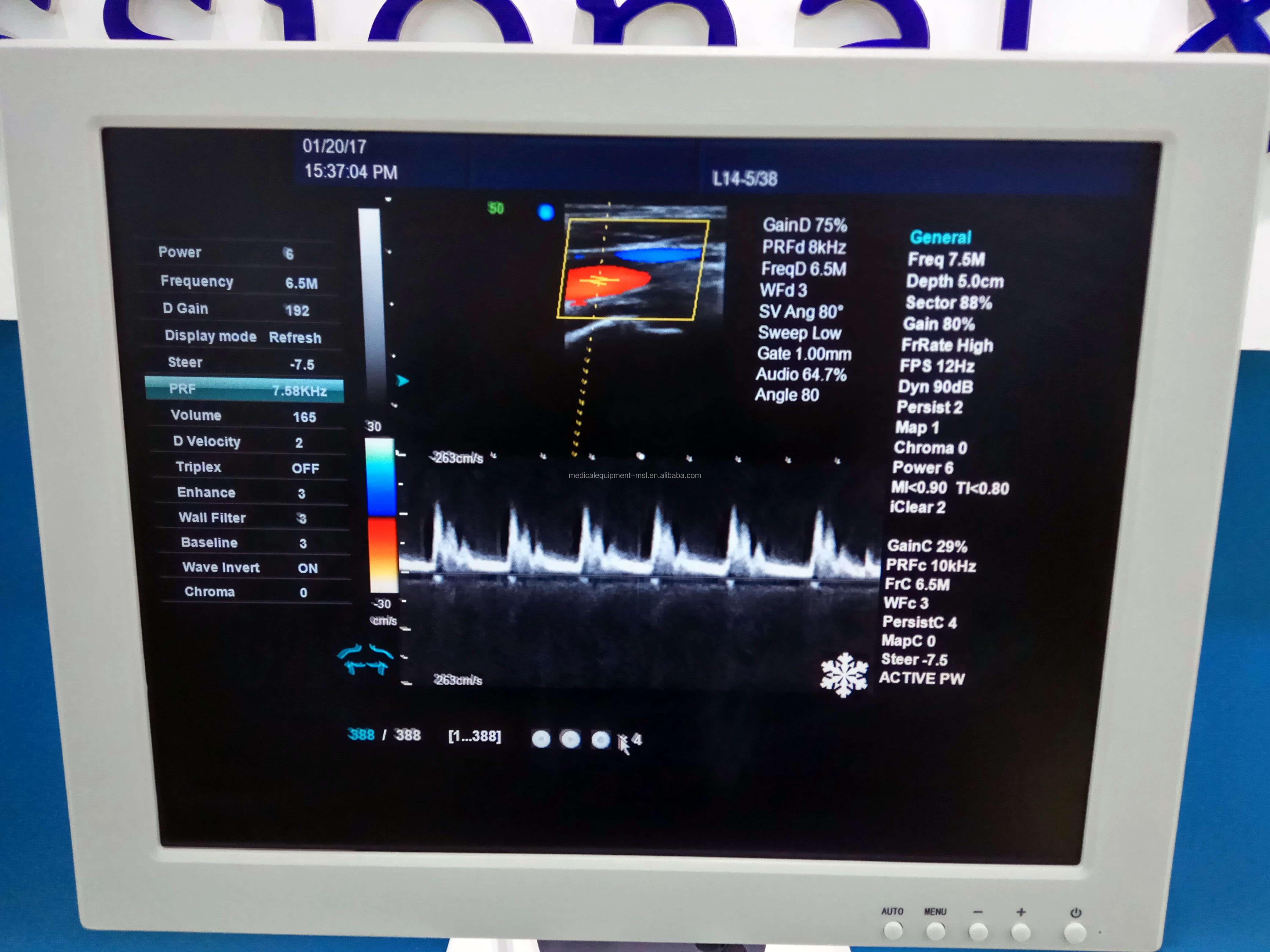 4D Color Doppler Ultrasound Machine Obstetrics And Gynecology Equipment Hospital