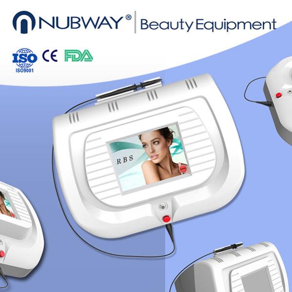 china best effective 30Mhz painfree RBS laser spider veins laser removal machine