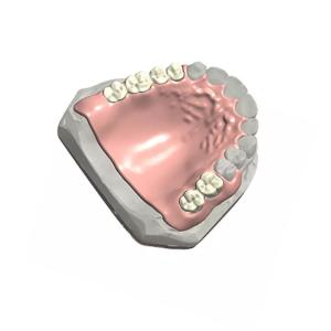 Wholesale Removable Dental Partial Denture Natural Color 3D Dental Model Customized from china suppliers