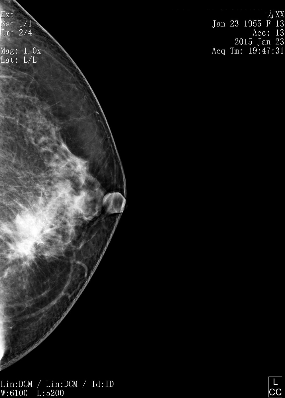Full Digital Mammography System with Panel Detector for Sales