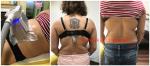 5 handles Cryolipolysis slimming device Coolsculpting fat freeze slimming