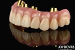 50ml Ti-Bar Acrylic Teeth Finish 24 Hours Curing Time United States For Dental