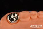 Dental Restoration Gold Metal Crowns for Oral Rehabilitation Treatment