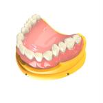 Denture Bases Biocompatible 3d Resin Pink Dental 3d Printing Resin
