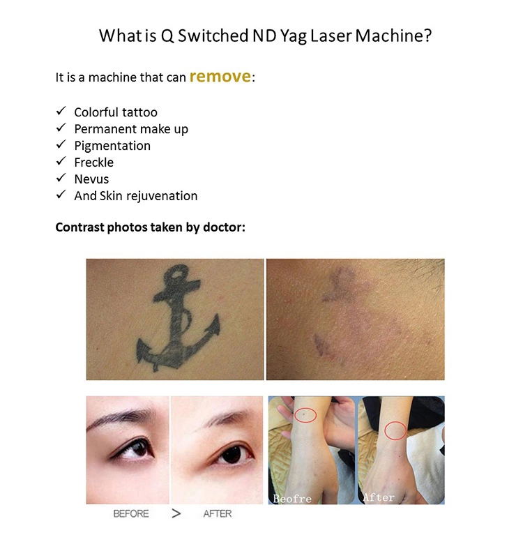 1064nm 532nm 1320nm Nd Yag Laser Equipment Portable For Skin Whitening