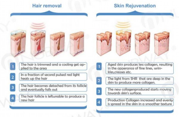 e-light hair removal ipl equipment,e-light ipl rf laser equipmen,e-light ipl hair remover