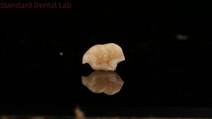 Wholesale Strength Emax Ceramic Crown Dental Onlay with Excellent Stain Resistance China Dental Lab from china suppliers
