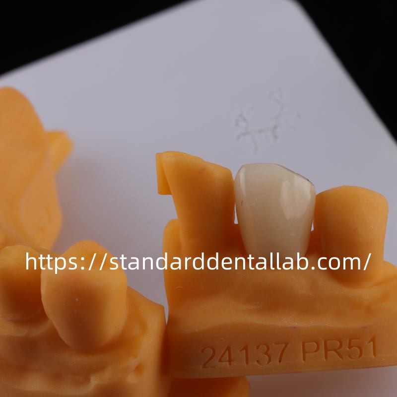 Full Contour Dental Lab Crowns High Translucency Solid Zirconia Crown China Dental Lab