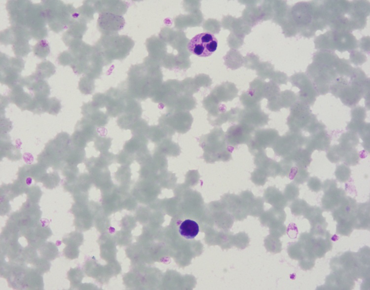 Stable Liu's Stain For Auto Stainer Baso Clear Colourful Medical Stains
