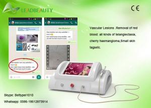 Wholesale 30MHz RBS blood vessel removal vascular lesion spider vein treatment machine from china suppliers
