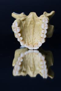 Wholesale Dental Lab Porcelain Zirconia Dental Crown 5 Stars Esthetics from china suppliers