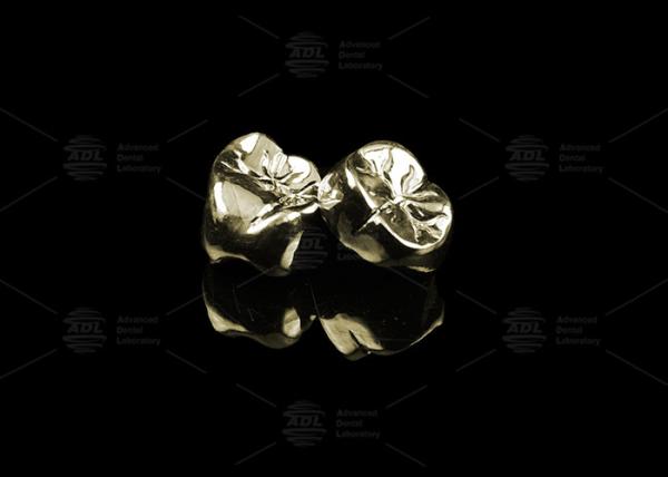 Sleek Full Cast Metal Crown Precious Alloy Gold 20% Polished Full Metal Dental