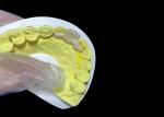Natural Looking Dental Ceramic Crown HPP Bonded Ceramic Bridge Easy Cleaning