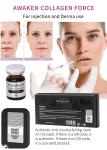 Wholesale Skin Brightening Anti Aging Collagen Dermal Fillers 5ml*5Vials