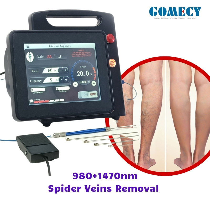 Blood Vessels Removal EVLT Laser Machine Dual Wavelength 980nm 1470nm Varicose Veins Beauty Personal Care