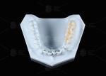 Translucency White Full Contour Zirconia Crown FCZ Monolithic Zirconia Crown