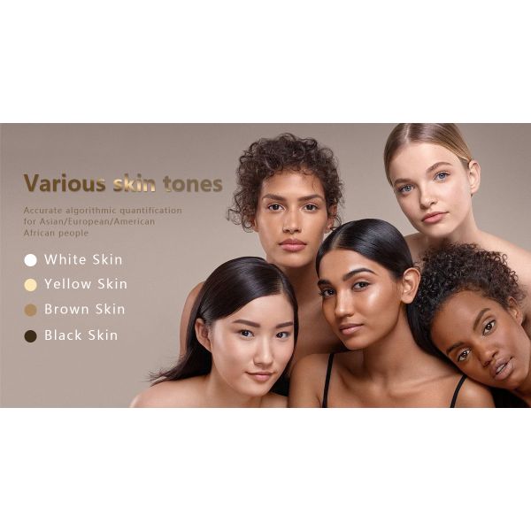 Skin Analyzer M8 smart AI powered skin analyzer providing detailed wrinkle pigmentation and acne analysis to enhance skincare consultations