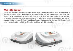 Wholesale Nubway 30MHz 0.01mm 0.03mm Needle Spider Veins Facial Veins Removal Machine from china suppliers
