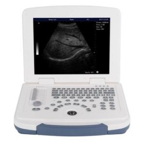 Wholesale ON SALE!!! Portable full digital laptop B&amp;W ultrasound scanner for hospital from china suppliers
