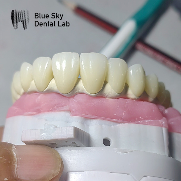 Sterilization Steam Sterilization Implant Cases with Universal Compatibility