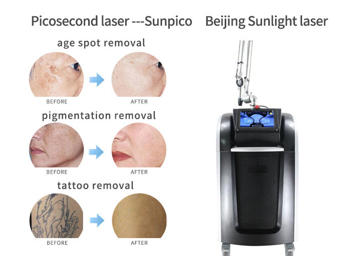 Ultra - Short Pulses Picosecond Laser Tattoo Removal Machine 1064nm / 532nm / 755nm