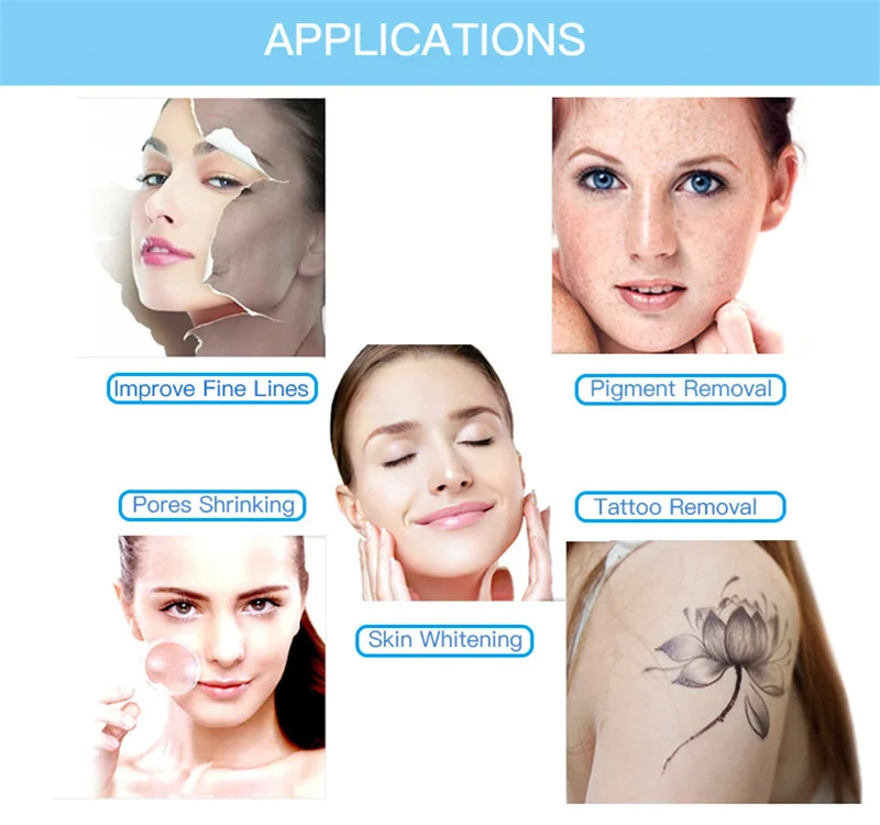 Q Switch Nd Yag Picosecond Laser Tattoo Removal Machine Skin Whitening