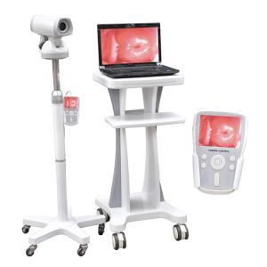 Wholesale Professional Video Colposcope Endoscope Gynaecology Colposcope CE03 from china suppliers