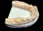 Custom Smooth Dental Ceramic Inlay for Staining Resistant Seamless Tooth Repair