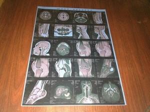 Wholesale Low Fog Medical X Ray Films , High Sharpness Konida X-ray Dry Film from china suppliers